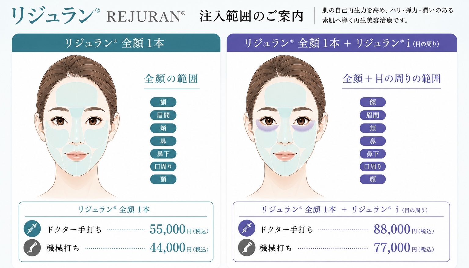 リジュラン®REJURAN。注入範囲のご案内リジュラン®全顔 1本肌の自己再生力を高め、ハリ・弾力・潤いのある素肌へ導く再生美容治療です。リジュラン®全顔 1本＋リジュラン®i（目の周り）全顔の範囲口周り顎全顔＋目の周りの範囲額眉間類鼻鼻下口周り顎リジュラン®全顔 1本ドクター手打ち機械打ち55,000円（税込）44,000円（税込）リジュラン®全顔1本+リジュラン®i（目の周り）ドクター手打ち機械打ち88,000円（税込）77,000円（税込）